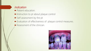 Indication
 Patient education.
 Instruction to pt about plaque control
 Self assessment by the pt
 Evaluation of effectiveness of plaque control measures.
 Assessment of the clinician.
 