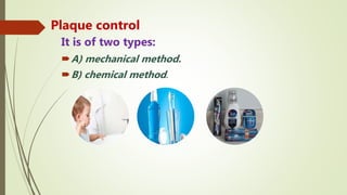 Plaque control
It is of two types:
A) mechanical method.
B) chemical method.
 
