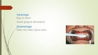 Advantage
Easy to learn
Good gingival stimulation
Disadvantage
Does not clean sulcus area.
 