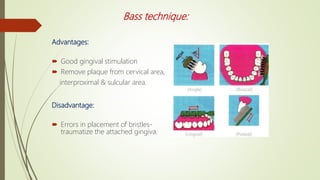 Advantages:
 Good gingival stimulation
 Remove plaque from cervical area,
interproximal & sulcular area.
Disadvantage:
 Errors in placement of bristles-
traumatize the attached gingiva.
Bass technique:
 