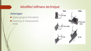 Modified stillmans technique
Advantages
 Good gingival stimulation
 Cleaning of interproximal
areas
 