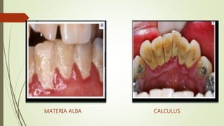 MATERIA ALBA CALCULUS
 