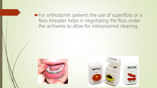 For orthodontic patients the use of superfloss or a
floss threader helps in negotiating the floss under
the archwires to allow for interproximal cleaning.
 