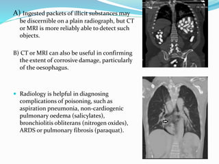 Ingesting Packets Identification of poisoning-EM ANDHRA2021 | PPTX