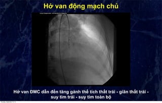 CHẨN ĐOÁN VÀ ĐIỀU TRỊ SUY TIM | PDF