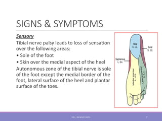 9. TIBIAL NERVE.pdf