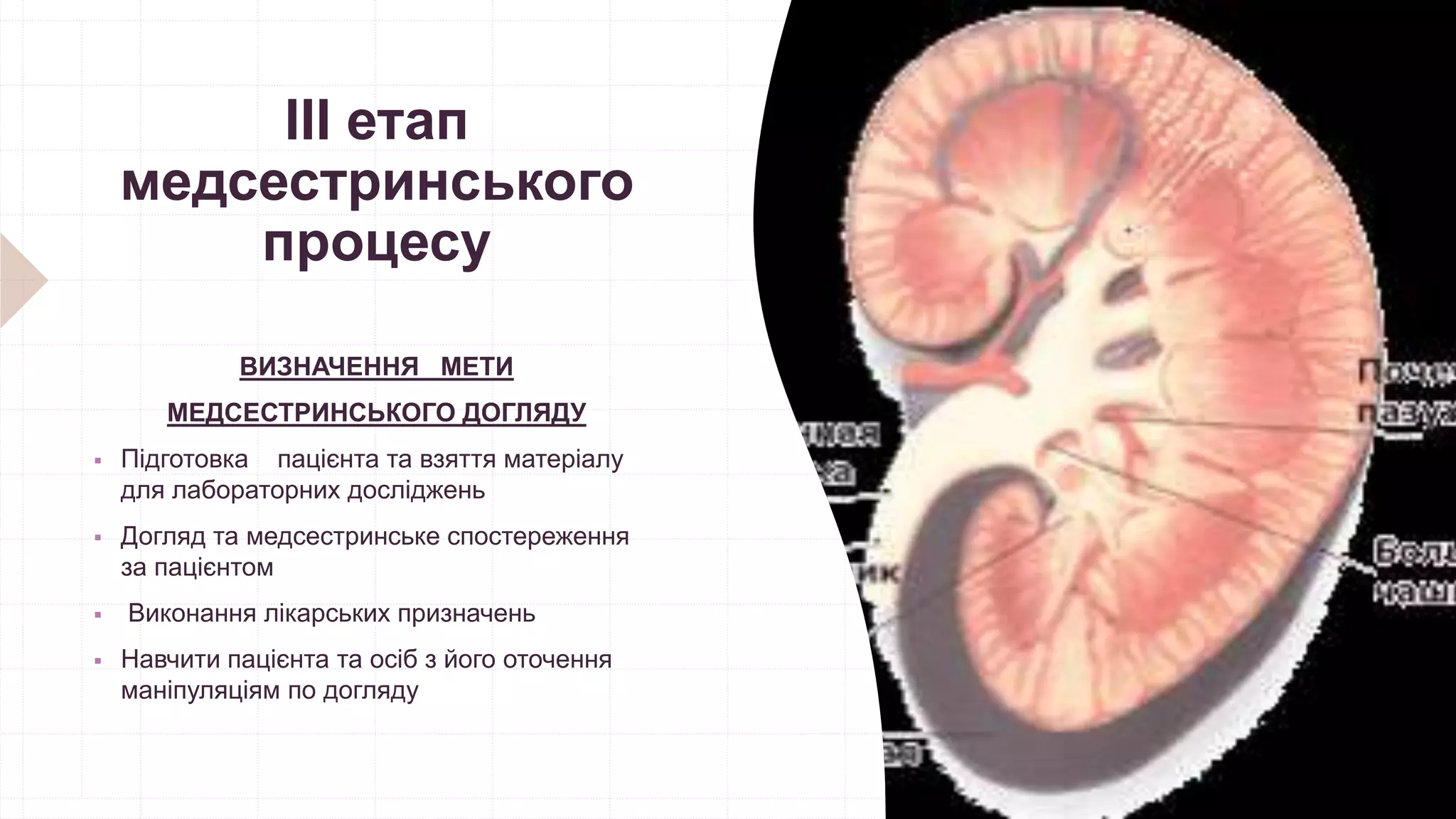 ІІІ етап
медсестринського
процесу
ВИЗНАЧЕННЯ МЕТИ
МЕДСЕСТРИНСЬКОГО ДОГЛЯДУ
 Підготовка пацієнта та взяття матеріалу
для лабораторних досліджень
 Догляд та медсестринське спостереження
за пацієнтом
 Виконання лікарських призначень
 Навчити пацієнта та осіб з його оточення
маніпуляціям по догляду
 