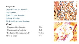 Reagents:
Crystal Violet, I% Solution.
Gram Iodine.
Basic Fuchsin Solution.
Gallego Solution.
Picric Acid-Acetone Solution.
Results :
• Gram-positive bacteria Blue
• Gram-negative bacteria Red
• Background tissue generally Yellow
• Nuclei Light red
 