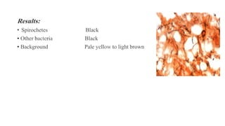 Results:
• Spirochetes Black
• Other bacteria Black
• Background Pale yellow to light brown
 