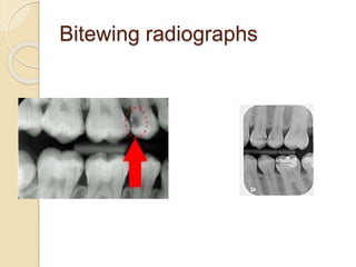 9. Dental Cariology.pptx