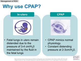 9. RDS _ using CPAP - April 2021(2).pptx