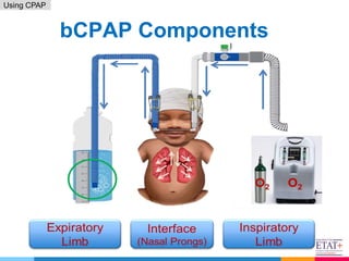 9. RDS _ using CPAP - April 2021(2).pptx