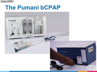 9. RDS _ using CPAP - April 2021(2).pptx