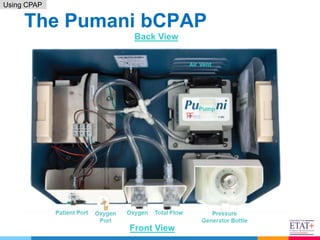 9. RDS _ using CPAP - April 2021(2).pptx