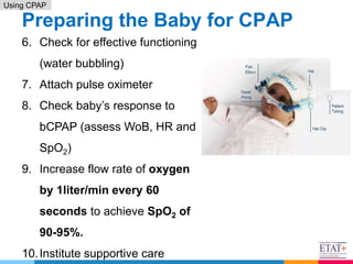9. RDS _ using CPAP - April 2021(2).pptx