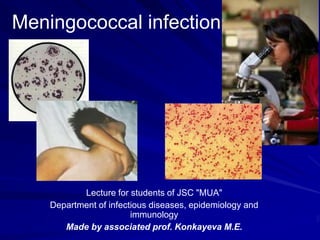Meningococcal infection
Lecture for students of JSC "MUA"
Department of infectious diseases, epidemiology and
immunology
Made by associated prof. Konkayeva M.E.
 