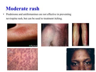 9.HIV[AIDS] infection for nurrse sir.ppt