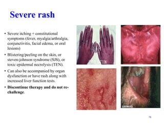 9.HIV[AIDS] infection for nurrse sir.ppt