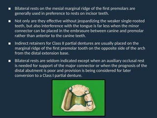 Indirect retainer in removable partial denture | PPTX