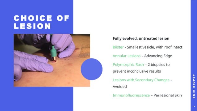 Skin Biopsy in Dermatology | PPTX | Skin and Dermatology | Diseases and ...