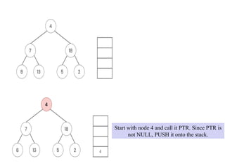 Start with node 4 and call it PTR. Since PTR is
not NULL, PUSH it onto the stack.
 