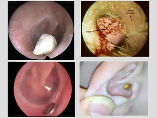 9. ENT Emergencies. Ear emergency, Nose emergency, Throat emergency | PDF
