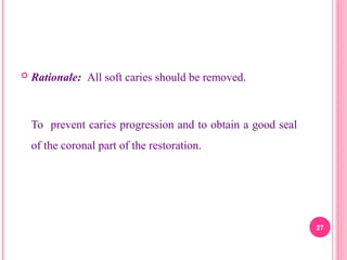  Rationale: All soft caries should be removed.
To prevent caries progression and to obtain a good seal
of the coronal part of the restoration.
27
 