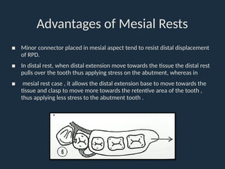 9. Indirect Retainers in removable partial denture | PPTX