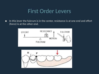 9. Indirect Retainers in removable partial denture | PPTX