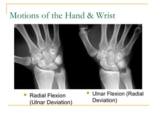 Hand Deviation upper limb anatomy and radiological master in upper limb | PPT