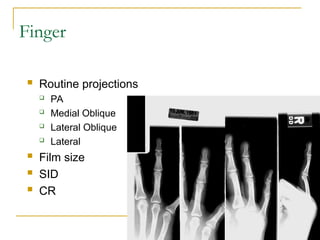 upper limb anatomy and radiological master in upper limb | PPT