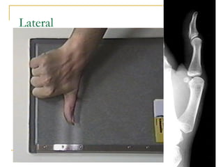 Unit Lateral upper limb anatomy and radiological master in upper limb | PPT