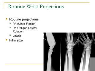 upper limb anatomy and radiological master in upper limb | PPT