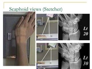 upper limb anatomy and radiological master in upper limb | PPT