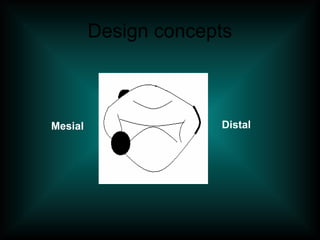 Design concepts
Distal
Mesial
 
