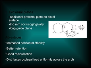 • Proximal plates
-additional proximal plate on distal
surface
-2-5 mm occlusogingivally
-long guide plane
Advantages:
•Increased horizontal stability
•Better retention
•Good reciprocation
•Distributes occlusal load uniformly across the arch
 