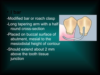 • I bar
-Modified bar or roach clasp
-Long tapering arm with a half
round cross-section
-Placed on buccal surface of
abutment, mesial to the
mesiodistal height of contour
-Should extend about 2 mm
above the tooth tissue
junction
 