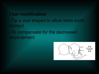• I bar modification
-Tip is pod shaped to allow more tooth
contact
-To compensate for the decreased
encirclement
 