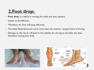 9.Deformities of humanbody last units of surgery I.pptx