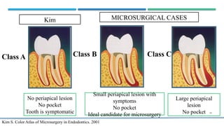 ENDODONTIC micro SURGERY- Surgical Endodontics.pptx
