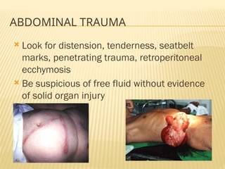 9. Abdominal Trauma resuscitation and management | PPTX