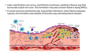 9. Reactive Oxygen Species and Diseases (2) Atherosclerosis (1).pdf