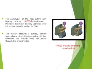 SELF LIGATING BRACKETS IN ORTHODONTICS.pptx