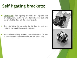 SELF LIGATING BRACKETS IN ORTHODONTICS.pptx