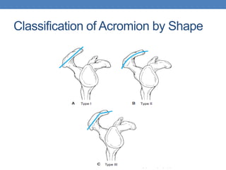 Comprehensive Overview and Management of Rotator Cuff Syndrome | PDF