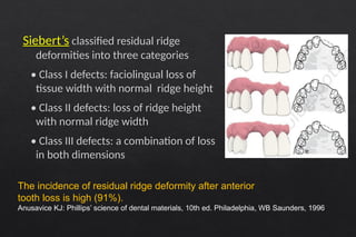 Siberet Ridge Defect Pontics in fixed partial denture prosthodontics | PPTX