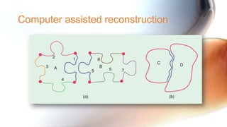 Computer assisted reconstruction
 