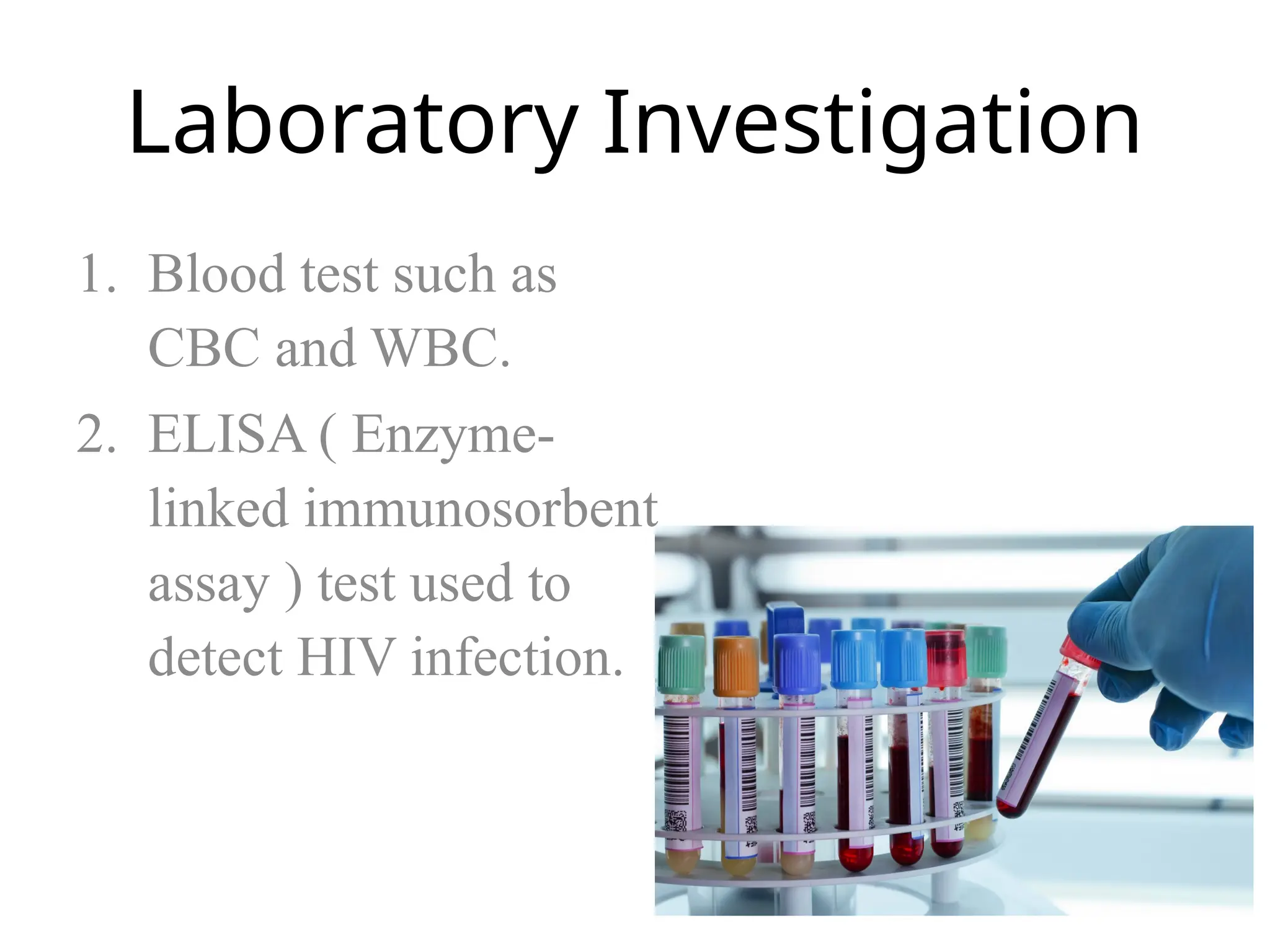 Laboratory Investigation
1. Blood test such as
CBC and WBC.
2. ELISA ( Enzyme-
linked immunosorbent
assay ) test used to
detect HIV infection.
 