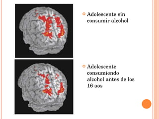 Adolescente sin consumir alcohol Adolescente consumiendo alcohol antes de los 16 aos  