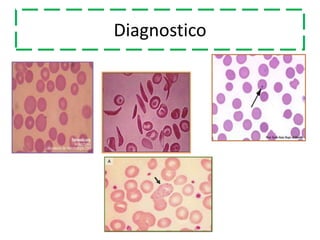 Diagnostico
 